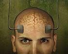 Shock therapy and the brain