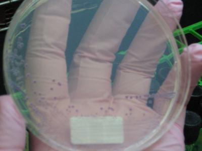 Silence on E. Coli outbreak highlights how Trump team’s changes undermine food safety